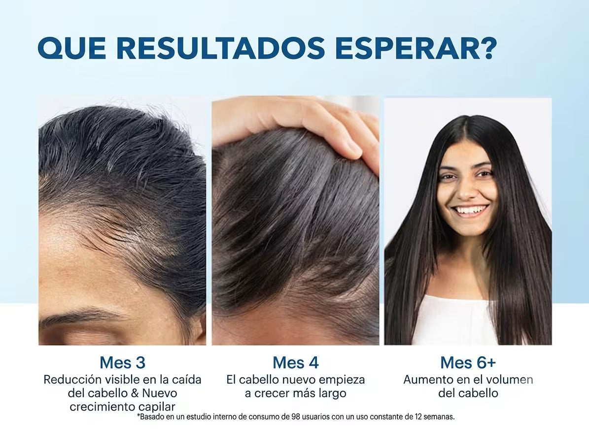 Bodywise — Sérum Capilar Anticaída · Roll-On