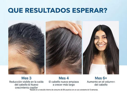 Bodywise — Sérum Capilar Anticaída · Roll-On