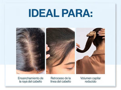 Bodywise — Sérum Capilar Anticaída · Roll-On
