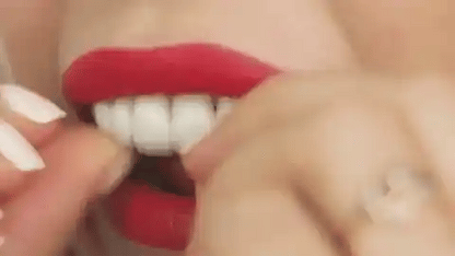 CARILLAS DENTALES ENVOLENTES SNAP ON SMILE